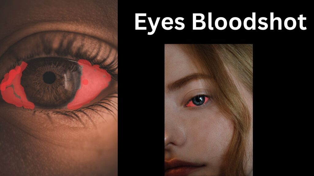 Why Are Your Eyes Bloodshot? Understanding the Causes and Remedies