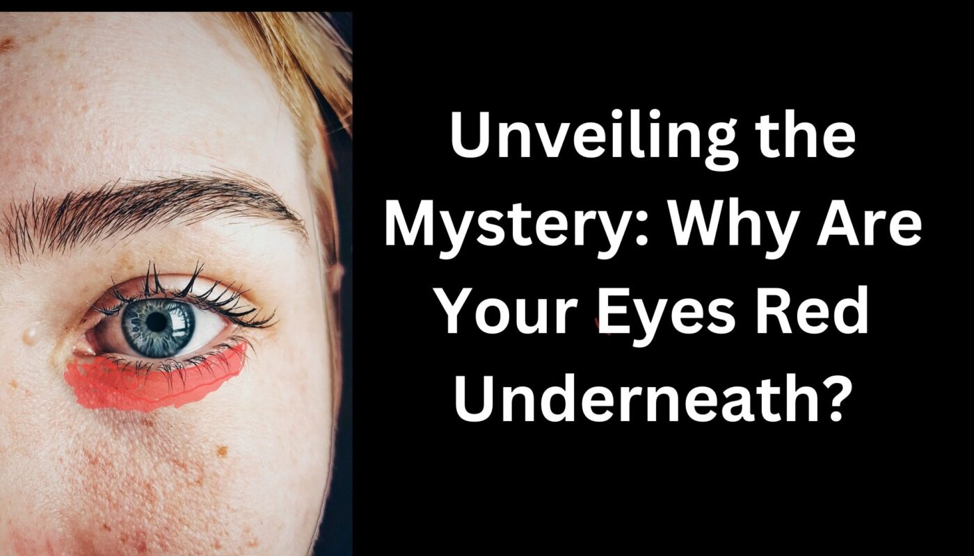 Unveiling the Mystery Why Are Your Eyes Red Underneath