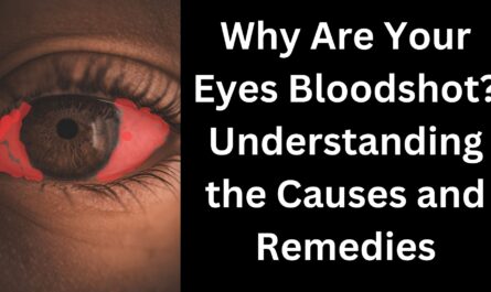 why are your eyes bloodshot?