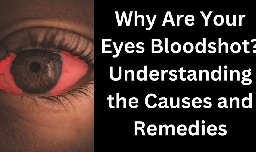 Why Are Your Eyes Bloodshot? Understanding the Causes and Remedies